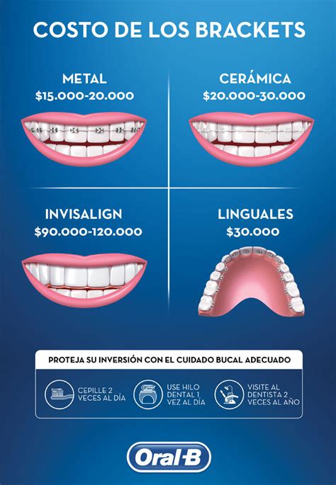 zafiro brackets metalicos|cuanto cobran por poner brackets.